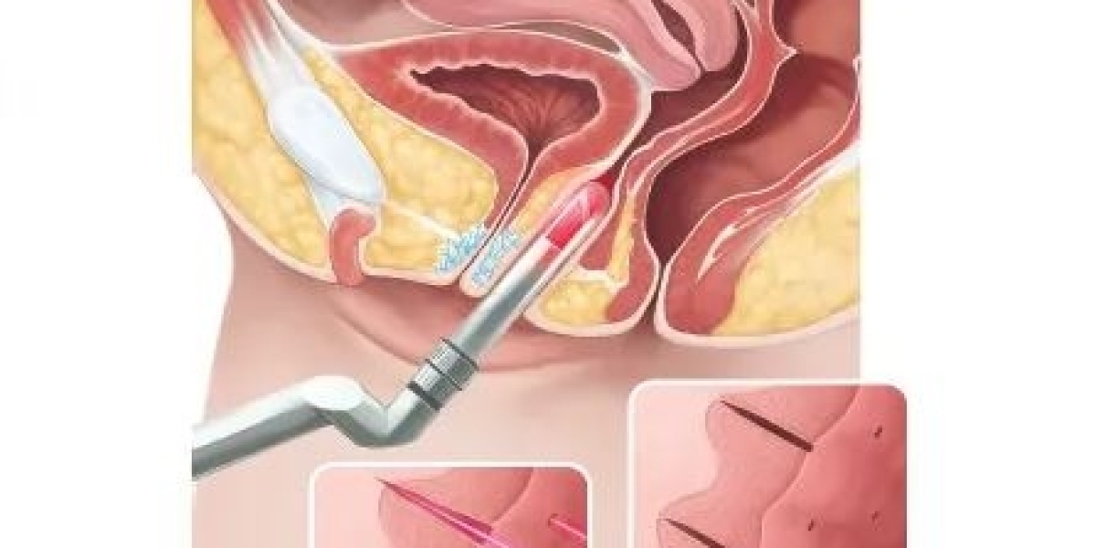 Vaginal Rejuvenation Market 2031: Dynamics, Future Plans, Size and Demand